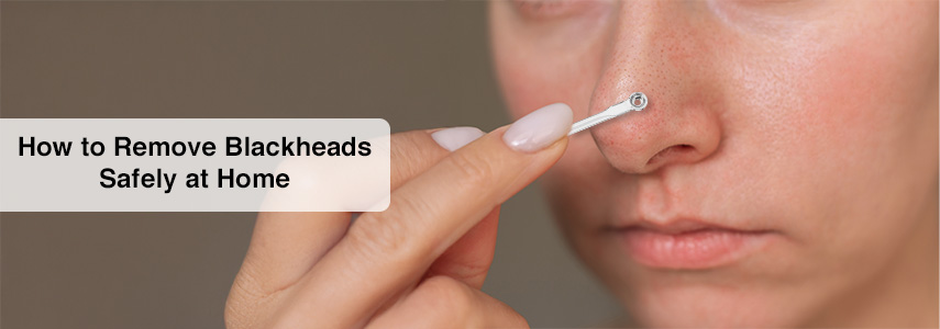 Essential Steps to Using a Blackhead Remover