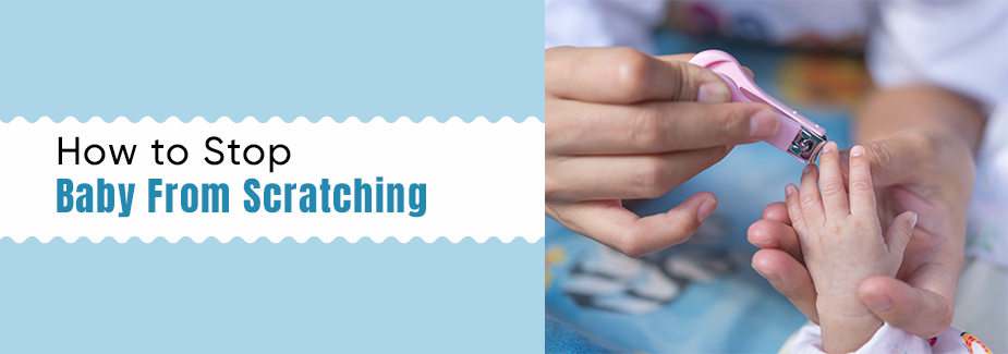How to Prevent Babies from Scratching Themselves in Winters